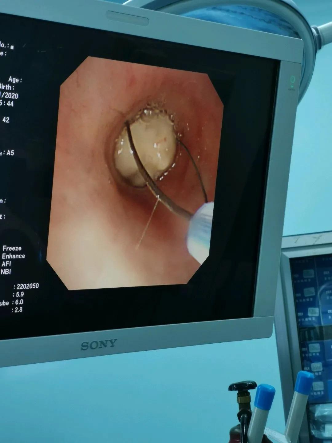 電子鼻咽喉鏡價(jià)格的市場(chǎng)定位分析，多元因素下的市場(chǎng)趨勢(shì)探討