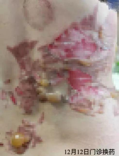 小巷特色養(yǎng)生館，最新拔罐圖片分享