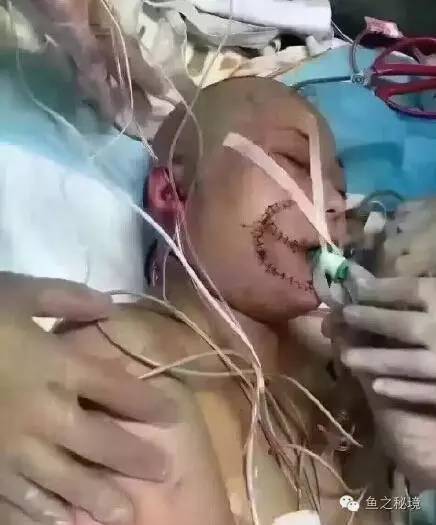 被虎咬的女子的最新消息，日常中的奇遇時(shí)刻